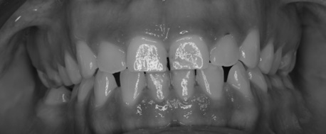 curso-atm-oclusion-dolor