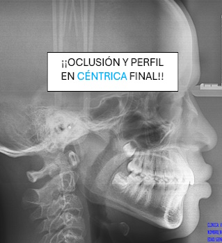 oclusion-y-perfil-en-centrica-final