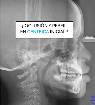 oclusion-y-perfil-en-centrica-inicial